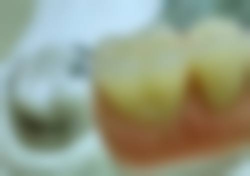 玉林蓝天口腔医院牙齿修复医生