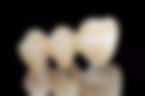 根管治疗可以一次性吗？不伴有炎症疼痛等少数情况，熟练医生一次可完成治疗