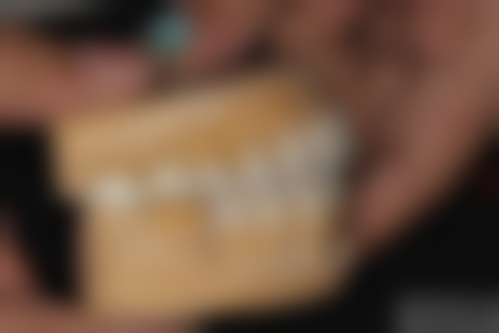 上饶牙博仕口腔：透明收费，拔牙服务贴心