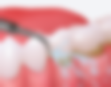 患者自身情况对烤瓷牙套使用时间的影响