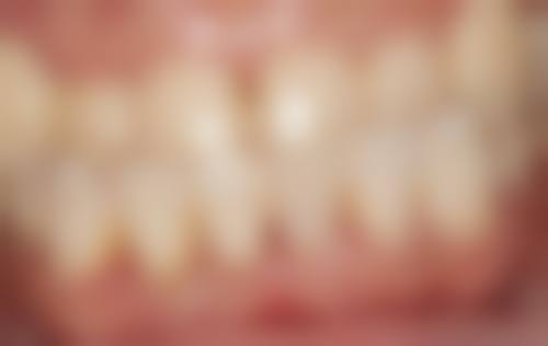 五、选择儿牙医院的注意事项：为孩子选好保护