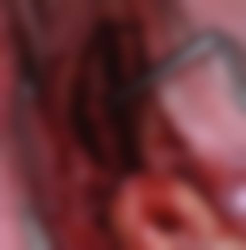 临汾建峰齿科医院半口种植亮点