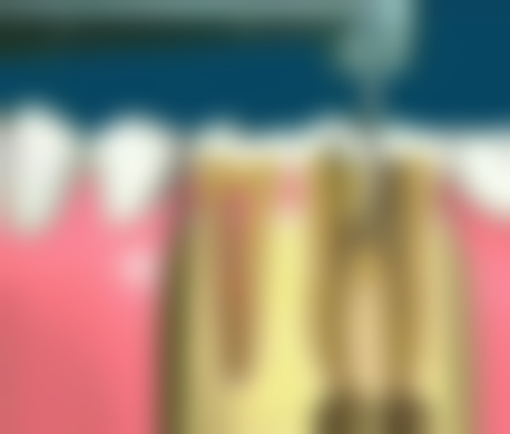 2026国内不同城市种植牙价格差异