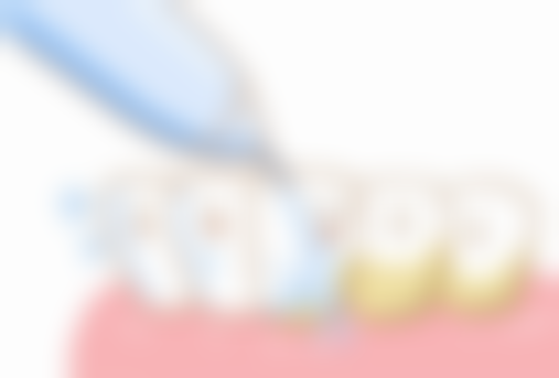 小孩下午拔牙好不好？取决于口腔状态、全身情况及术后观察便利性等因素