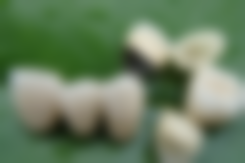 湛江义齿镶牙价格全知道