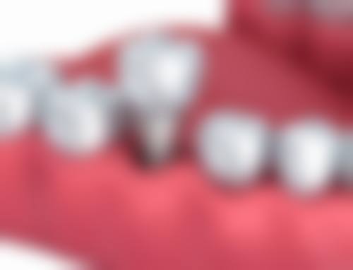 佛山贝壳口腔门诊部详细的预约挂号方式及流程