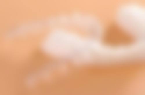 嵌体补牙材料之金属