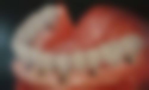 宿州市立医院口腔科真人口碑评价怎么样？