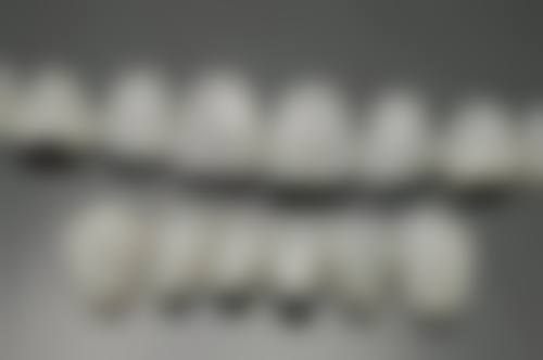 补牙后口腔清洁注意要点