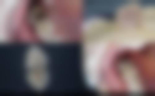 禹城店特色：卡通诊室让孩子爱上看牙