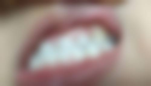 锦州儿牙医生24小时在线咨询：京医张婕妤医生擅早期干预，收费低超靠谱！ 