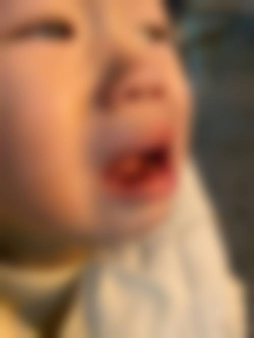 张婕妤医生团队收费价格优势