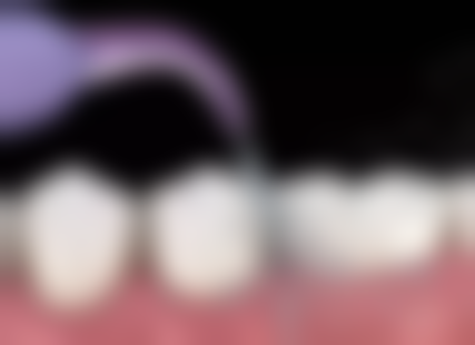 潍坊寒亭康齿口腔详细的预约挂号方式及流程