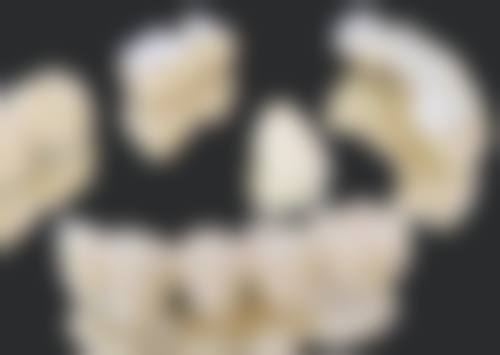 某口腔的矫正实例及费用