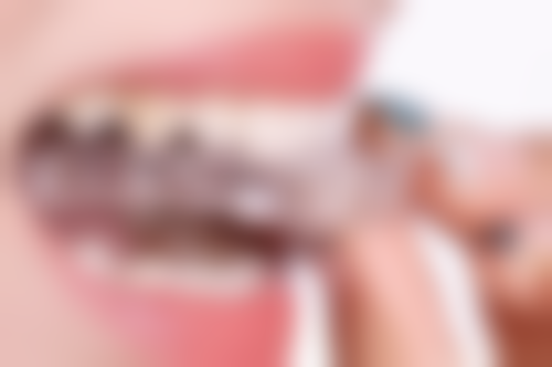 补牙后进食的注意事项