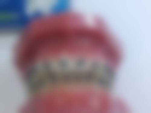 精选拔牙商户优惠大放送