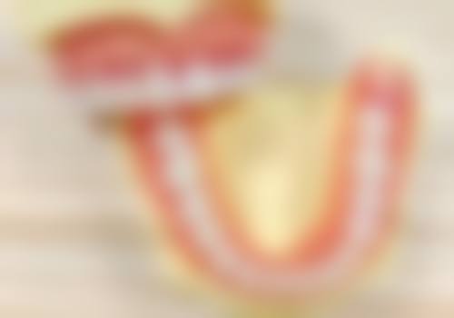 补牙用的玻璃离子材料做成的情况