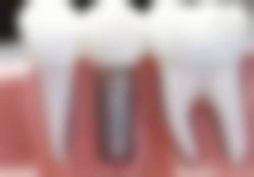 无锡一壹口腔真人口碑评价怎么样？