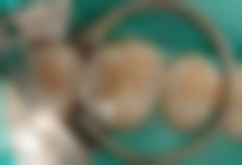 {河北儿牙在线咨询24小时，靠谱吗？多机构优势揭秘，乳牙矫正5000元起！ 