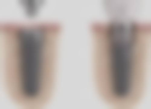 郑州植得口腔：专科医院的镶牙实力