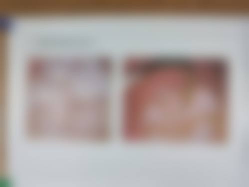 无锡一壹口腔详细的预约挂号方式及流程