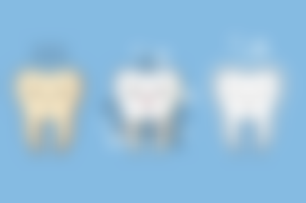 补牙用什么材料做成的？树脂、玻璃离子、银汞合金等材料各有优劣