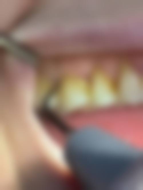 在线询问：开启矫正之旅