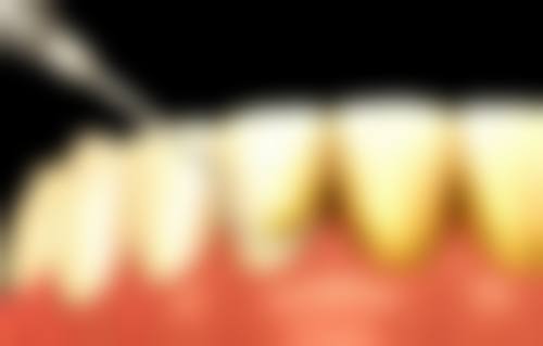 四、贴心保护：万超口腔诊所的服务优势