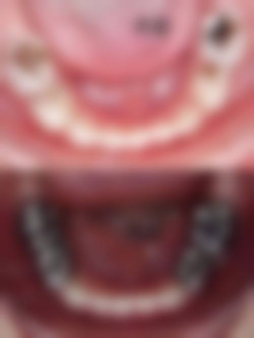 三、珠海其他隐形矫正医院推荐