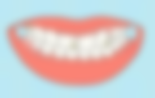 做了根管治疗要做牙冠吗？做牙冠可保护牙齿、恢复功能，[医院名称]修复效果获患者好评 