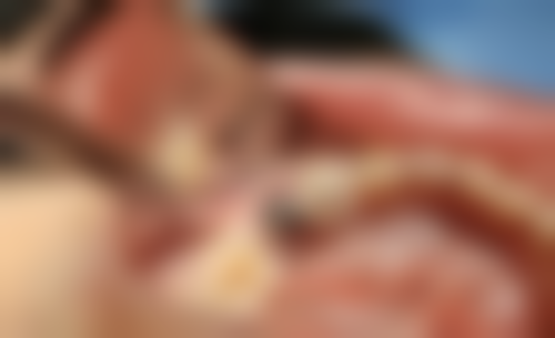 广东中山兴华口腔地址电话营业时间