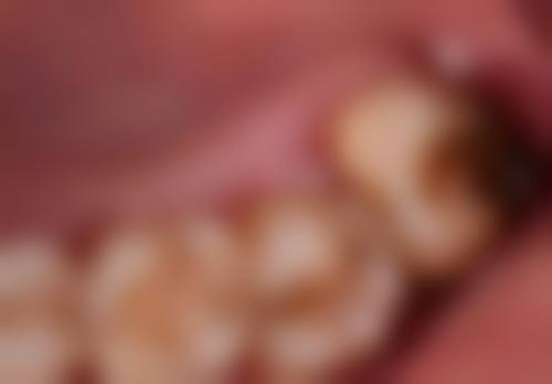 2026医院牙科常见项目收费价格