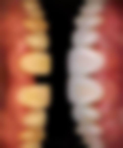 宜昌西陵美思特口腔门诊部详细的预约挂号方式及流程