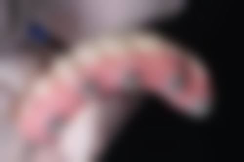 专精医院应对拔牙后遗症的方案