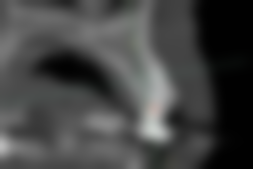 上海美田口腔门诊部真人口碑评价怎么样？