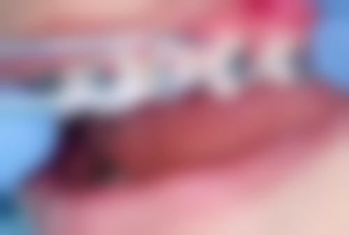 不同拔牙情况对应的挂号科室