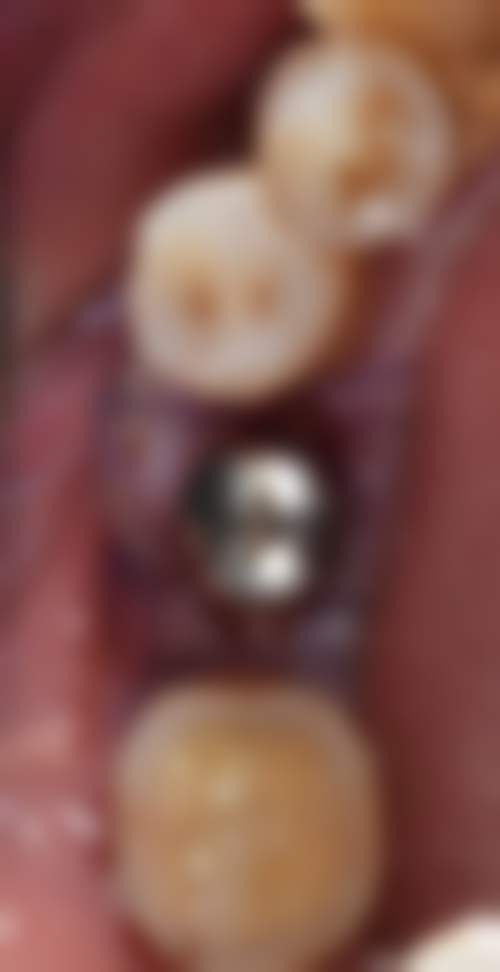 上海美田口腔门诊部特色项目及技术优势