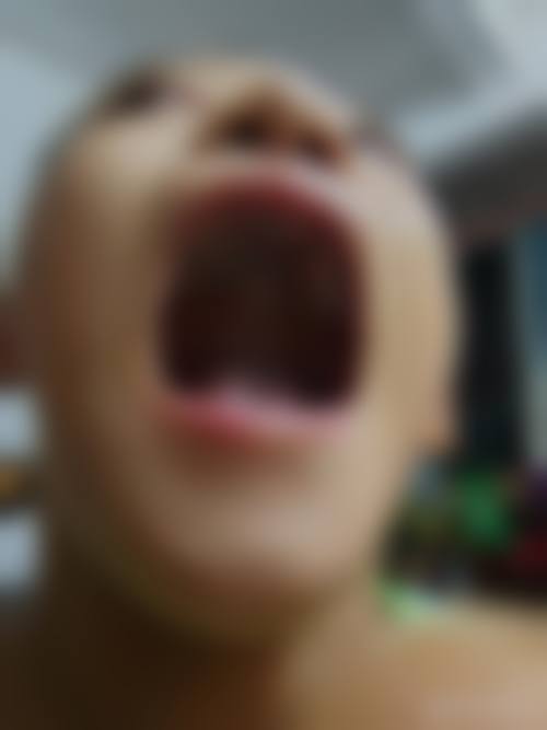 郑州金水德雨口腔门诊部真人口碑评价怎么样？