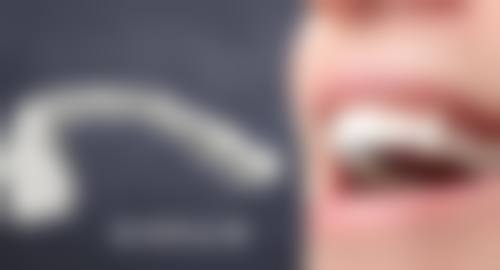 欧贝口腔肖林喜医生应对疑难病例