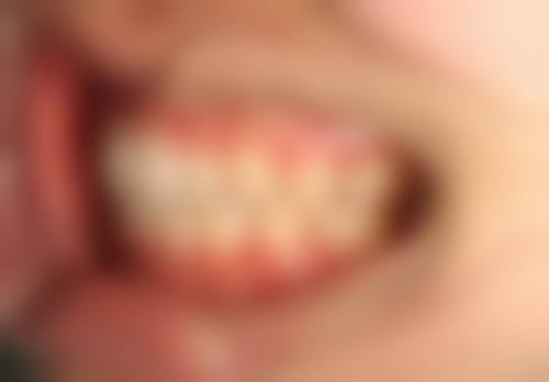 {呼和浩特牙齿矫正医生24小时在线咨询？华医、合创等医院正畸优势及收费揭秘！ 