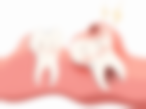 活动义齿每天要戴多久？初期适应阶段与长期佩戴时长究竟有何不同？ 