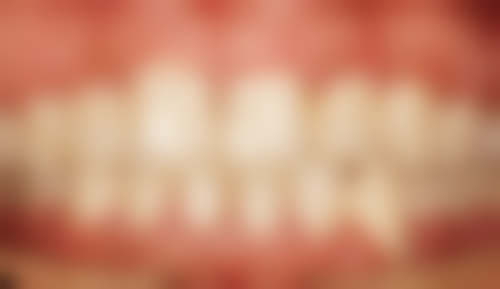 {安阳北关添悦口腔门诊部冯国周的擅长领域有哪些？种植牙、美学修复、牙齿矫正他都在行！ 