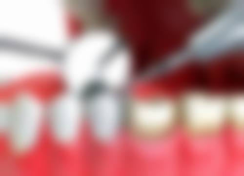 綦江万盛张莉莉口腔诊所价格表/收费标准