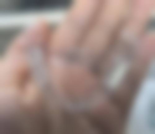 荆州牙牙邦口腔真人口碑评价怎么样?