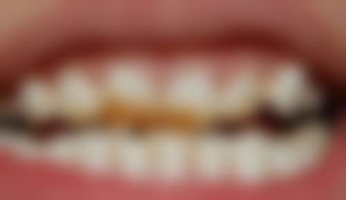 {台山口腔医院排名：台山市人民医院、康美口腔等上榜，含诊疗优势与预约方式 