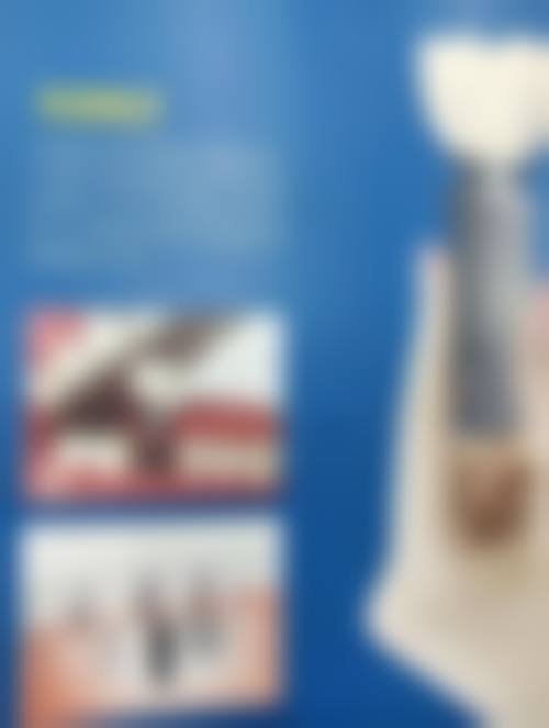 {滁州全口种植医院在线咨询24小时！选滁州口腔医院，技术优、服务好、费用还透明！ 