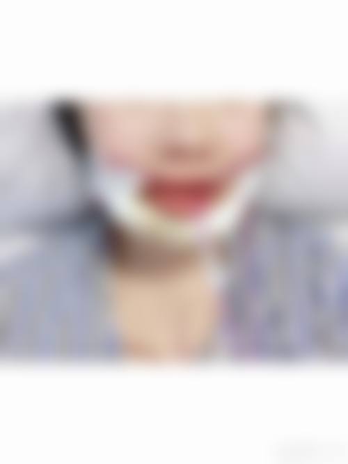 青上刘萌萌医生正畸特色