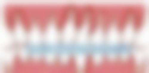 五岁宝宝地包天治疗之擅长项目