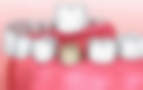 小孩地包天能矫正的口碑评价