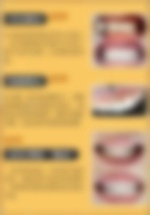 贵州贵阳龅牙兔口腔特色项目及技术优势